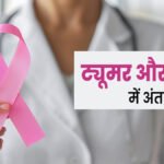 Health news : क्या आपको पता है ट्यूमर और कैंसर में फर्क??, क्या बायोप्सी करवाने से कैंसर और अधिक फैल सकता है?? जानें सारे जवाब