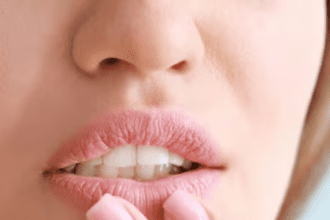 These home remedies can prevent lips from cracking in winter, start from today itself.