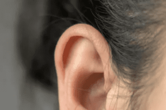 What should I put in my ear so that all the dirt comes out automatically? These home remedies will help me in cleaning my ears