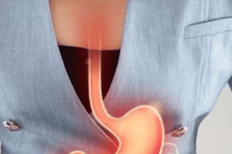 How to loosen stool stuck in intestines?