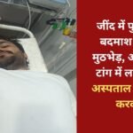 Police encounter with a criminal in Jind, accused shot in the leg, admitted to hospital
